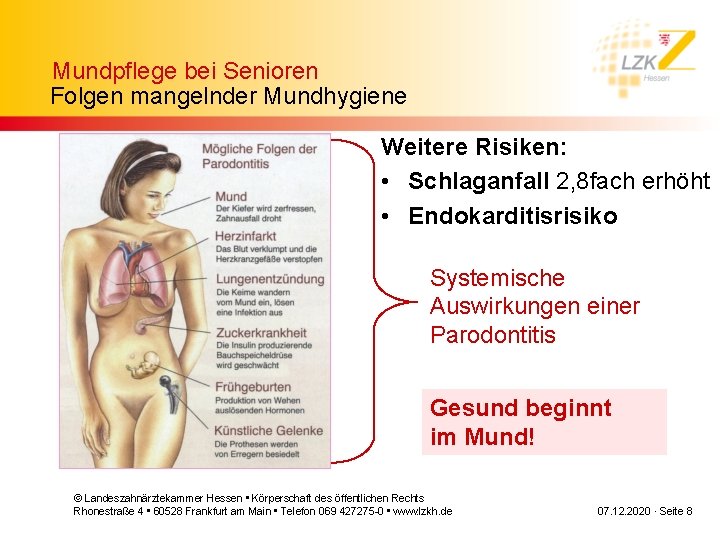Mundpflege bei Senioren Folgen mangelnder Mundhygiene Weitere Risiken: • Schlaganfall 2, 8 fach erhöht