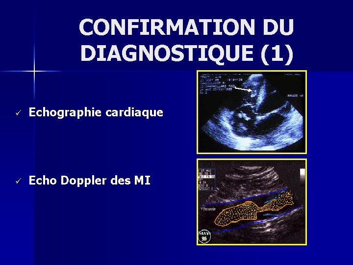 CONFIRMATION DU DIAGNOSTIQUE (1) ü Echographie cardiaque ü Echo Doppler des MI 