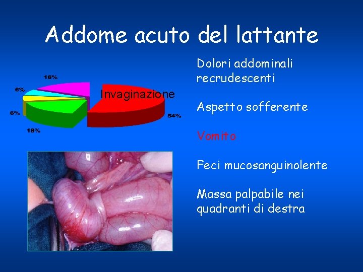 Addome acuto del lattante Dolori addominali recrudescenti Invaginazione Aspetto sofferente Vomito Feci mucosanguinolente Massa