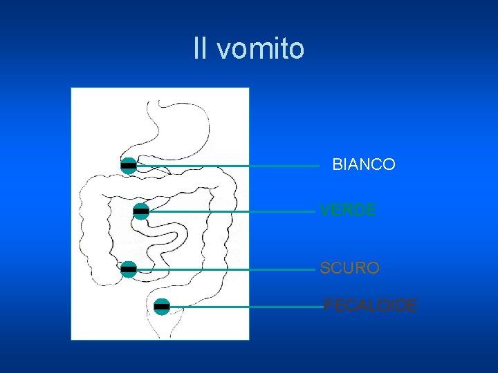 Il vomito BIANCO VERDE SCURO FECALOIDE 
