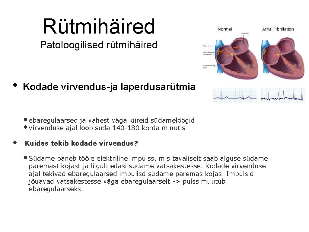 Rütmihäired Patoloogilised rütmihäired • Kodade virvendus-ja laperdusarütmia • ebaregulaarsed ja vahest väga kiireid südamelöögid