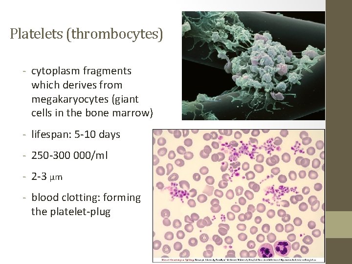 Platelets (thrombocytes) - cytoplasm fragments which derives from megakaryocytes (giant cells in the bone