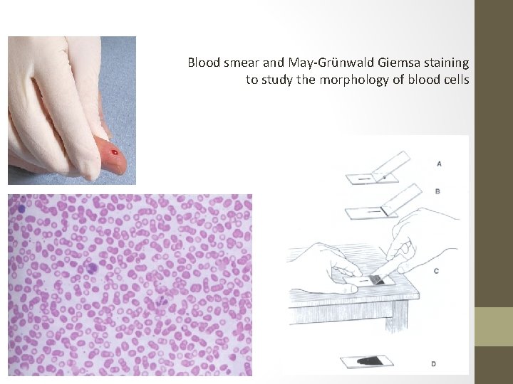 Blood smear and May-Grünwald Giemsa staining to study the morphology of blood cells 