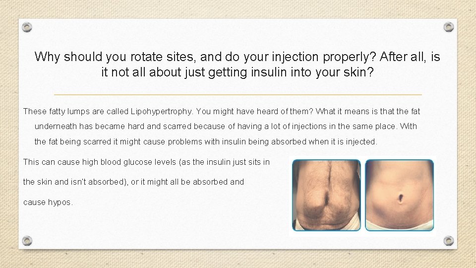 Why should you rotate sites, and do your injection properly? After all, is it