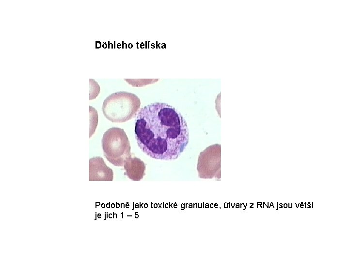 Döhleho tělíska Podobně jako toxické granulace, útvary z RNA jsou větší je jich 1