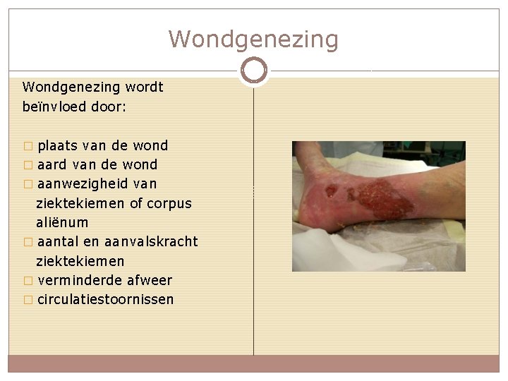 Wondgenezing wordt beïnvloed door: � plaats van de wond � aard van de wond