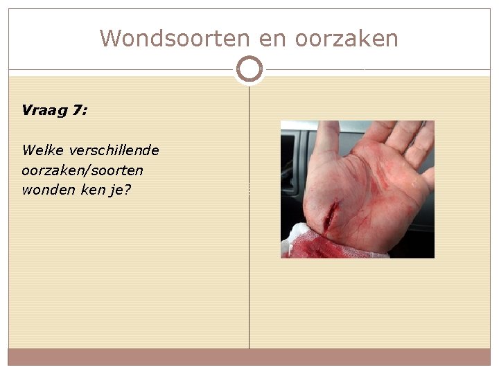Wondsoorten en oorzaken Vraag 7: Welke verschillende oorzaken/soorten wonden ken je? 