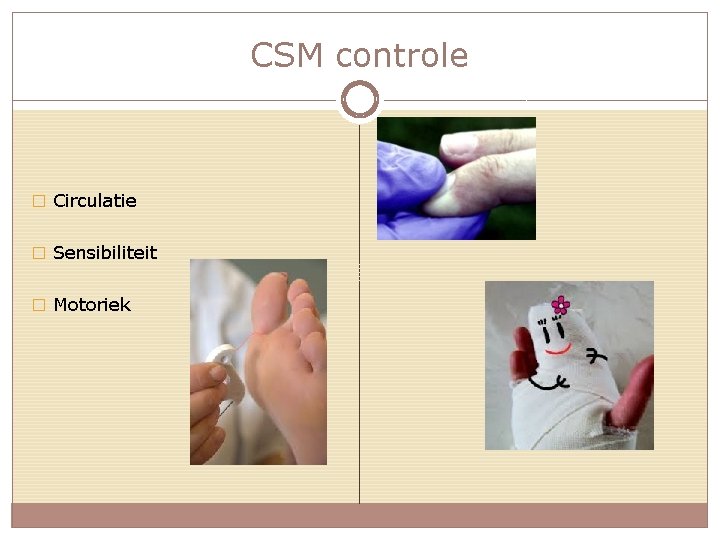 CSM controle � Circulatie � Sensibiliteit � Motoriek 