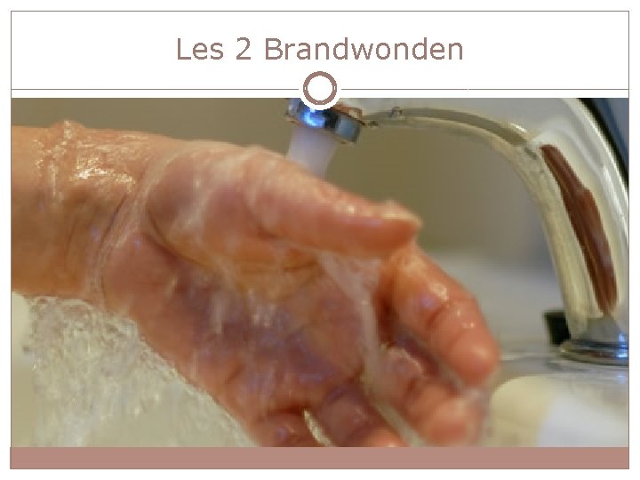 Les 2 Brandwonden 