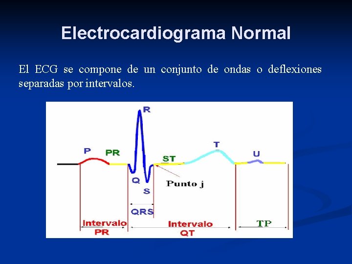 Electrocardiograma Normal El ECG se compone de un conjunto de ondas o deflexiones separadas