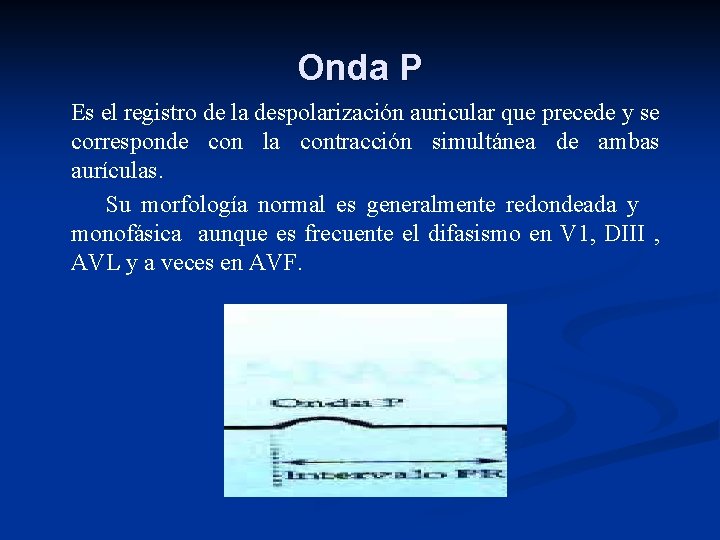 Onda P Es el registro de la despolarización auricular que precede y se corresponde
