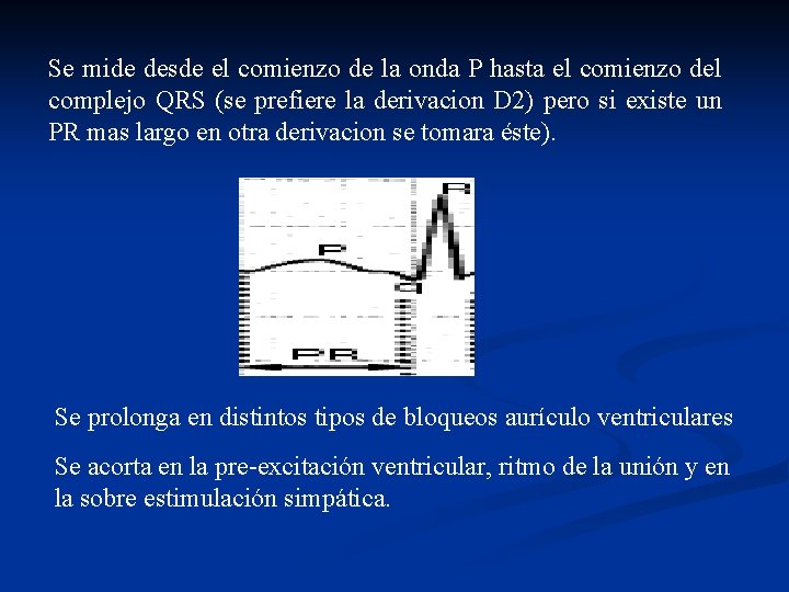 Se mide desde el comienzo de la onda P hasta el comienzo del complejo