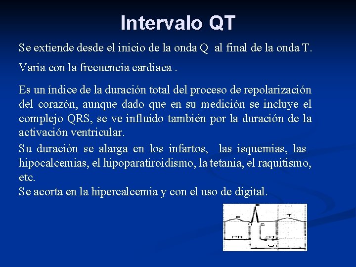 Intervalo QT Se extiende desde el inicio de la onda Q al final de
