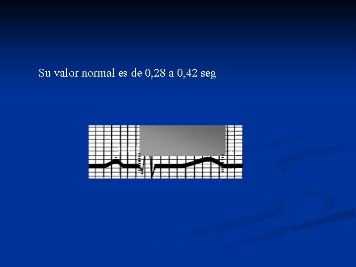 Su valor normal es de 0, 28 a 0, 42 seg 
