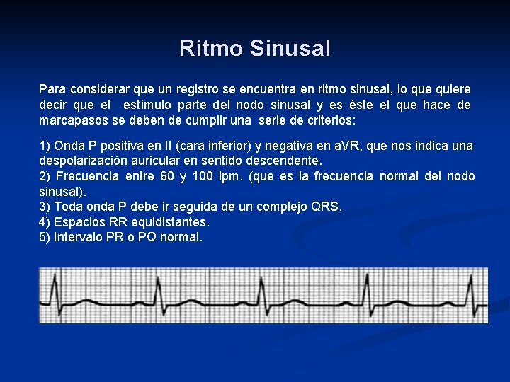 Ritmo Sinusal Para considerar que un registro se encuentra en ritmo sinusal, lo que