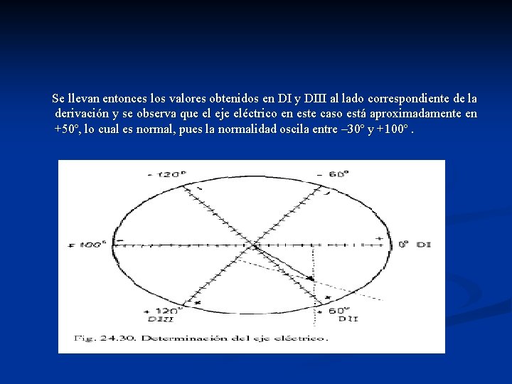  Se llevan entonces los valores obtenidos en DI y DIII al lado correspondiente