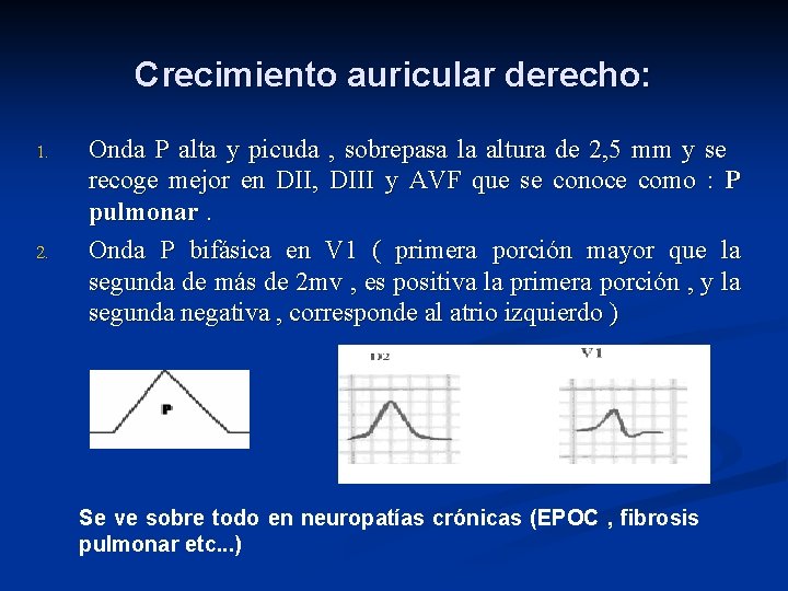 Crecimiento auricular derecho: 1. 2. Onda P alta y picuda , sobrepasa la altura
