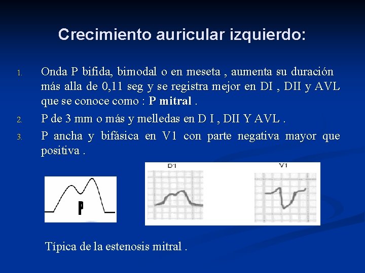 Crecimiento auricular izquierdo: 1. 2. 3. Onda P bifida, bimodal o en meseta ,
