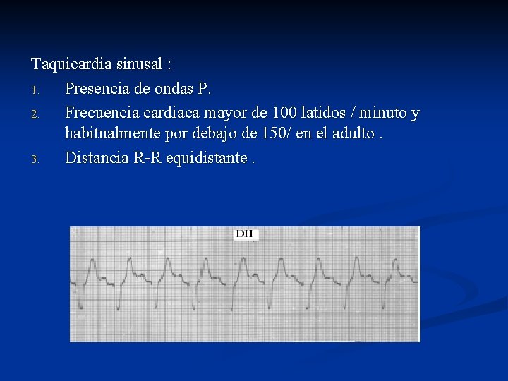 Taquicardia sinusal : 1. Presencia de ondas P. 2. Frecuencia cardiaca mayor de 100