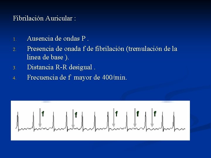 Fibrilación Auricular : 1. 2. 3. 4. Ausencia de ondas P. Presencia de onada