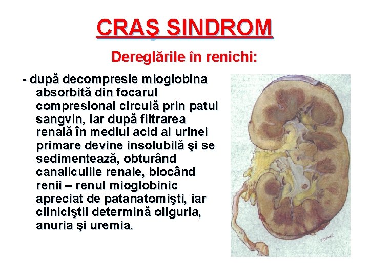 CRAŞ SINDROM Dereglările în renichi: - după decompresie mioglobina absorbită din focarul compresional circulă