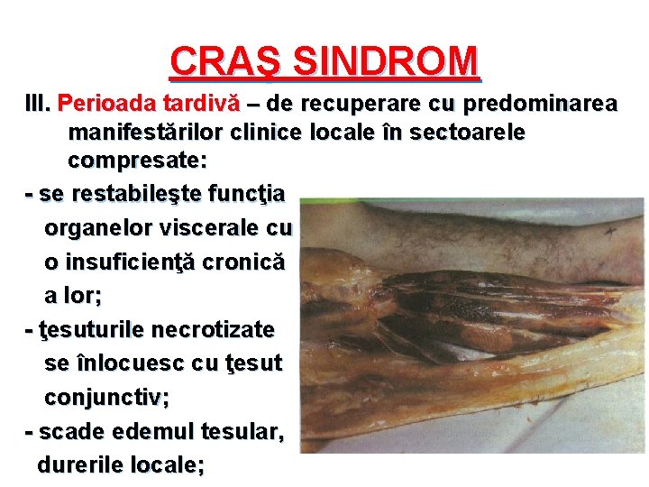 CRAŞ SINDROM III. Perioada tardivă – de recuperare cu predominarea manifestărilor clinice locale în
