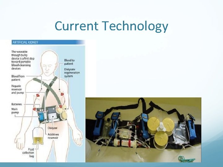 Current Technology 