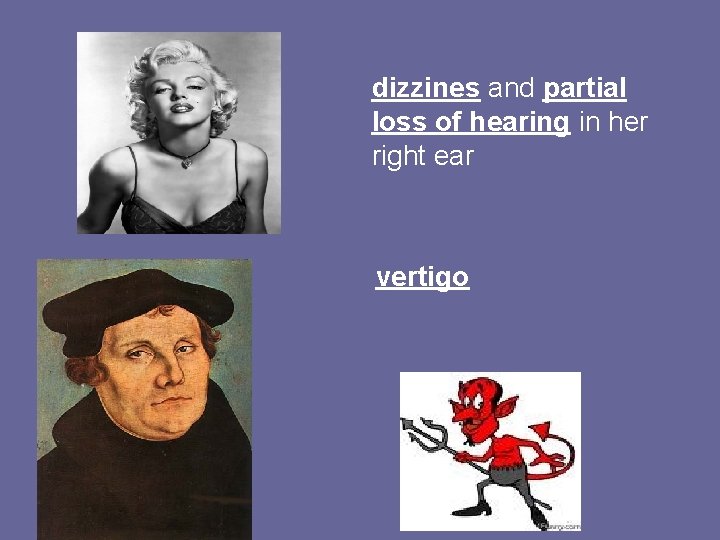 dizzines and partial loss of hearing in her right ear vertigo 