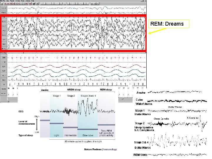 REM: Dreams REM: Dreams