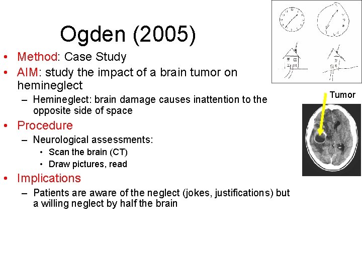 Ogden (2005) • Method: Case Study • AIM: study the impact of a brain Ogden (2005) • Method: Case Study • AIM: study the impact of a brain