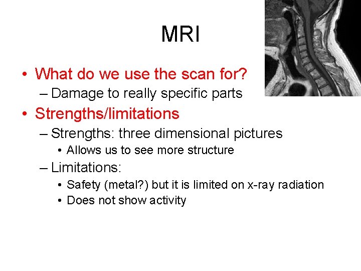 MRI • What do we use the scan for? – Damage to really specific MRI • What do we use the scan for? – Damage to really specific