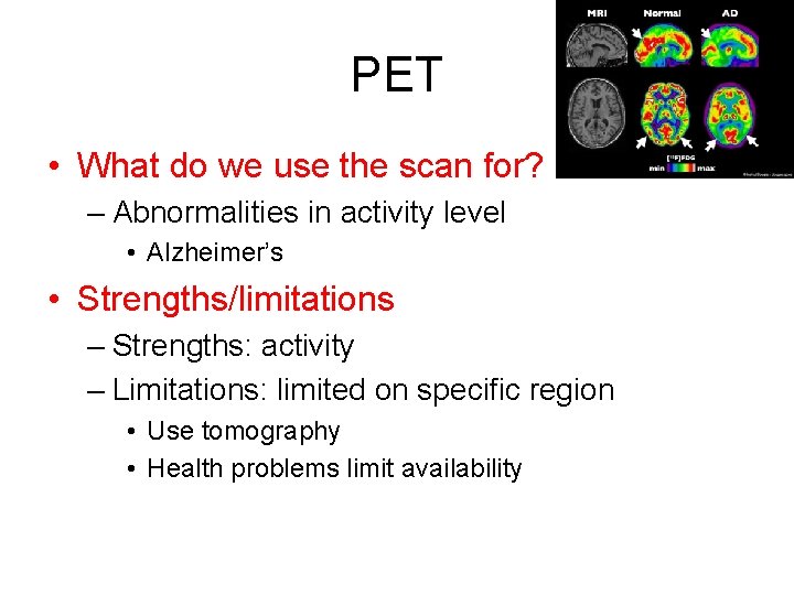 PET • What do we use the scan for? – Abnormalities in activity level PET • What do we use the scan for? – Abnormalities in activity level