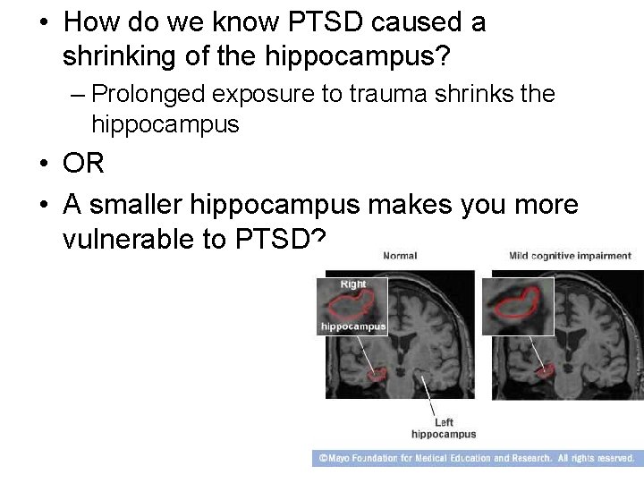 • How do we know PTSD caused a shrinking of the hippocampus? – • How do we know PTSD caused a shrinking of the hippocampus? –
