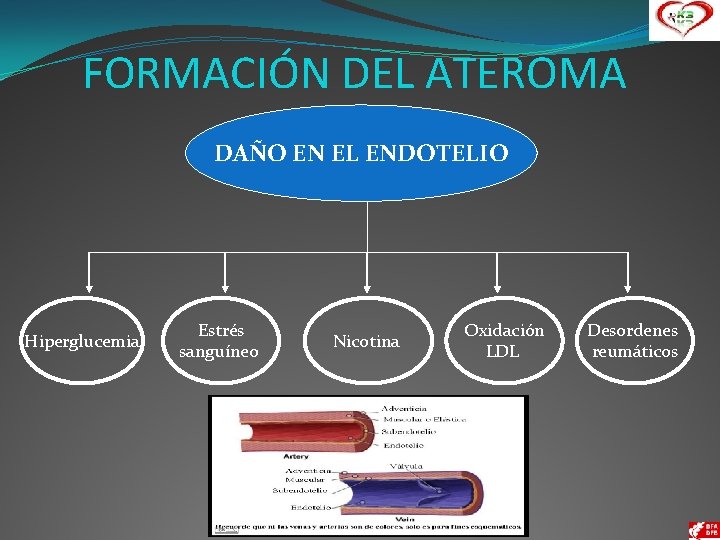 FORMACIÓN DEL ATEROMA DAÑO EN EL ENDOTELIO Hiperglucemia Estrés sanguíneo Nicotina Oxidación LDL Desordenes