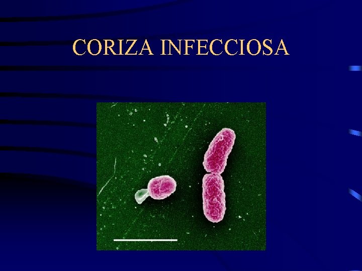 CORIZA INFECCIOSA 