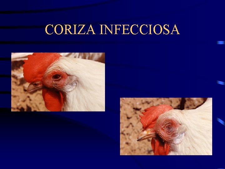 CORIZA INFECCIOSA 