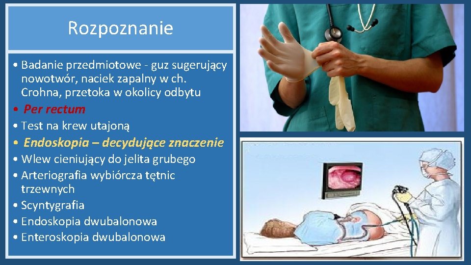 Rozpoznanie • Badanie przedmiotowe - guz sugerujący nowotwór, naciek zapalny w ch. Crohna, przetoka