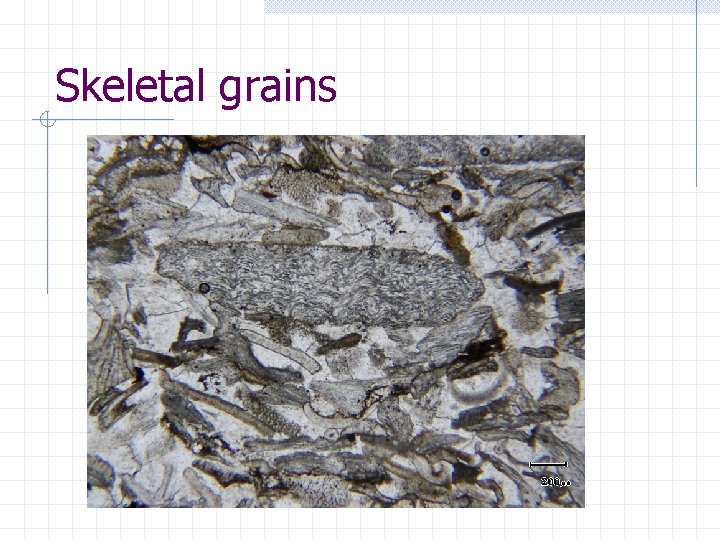 Skeletal grains Skeletal grains