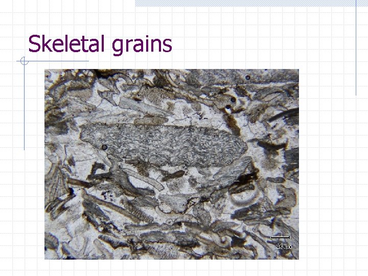 Skeletal grains 