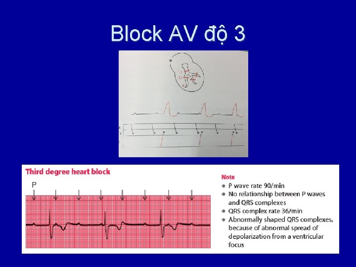 Block AV độ 3 