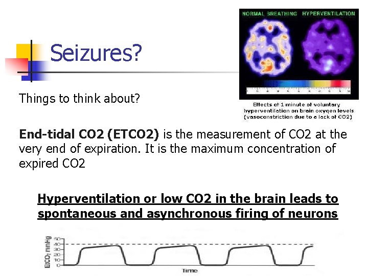 Seizures? Things to think about? End-tidal CO 2 (ETCO 2) is the measurement of