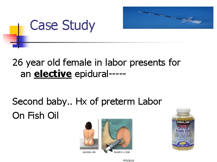 Case Study 26 year old female in labor presents for an elective epidural----Second baby.