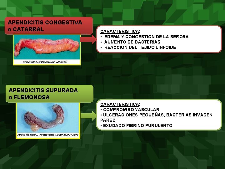 APENDICITIS CONGESTIVA o CATARRAL CARACTERISTICA: • EDEMA Y CONGESTION DE LA SEROSA • AUMENTO