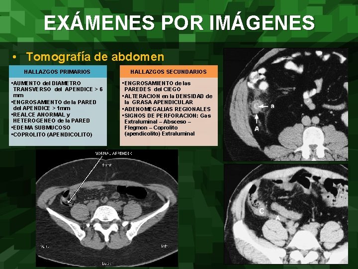 EXÁMENES POR IMÁGENES • Tomografía de abdomen HALLAZGOS PRIMARIOS HALLAZGOS SECUNDARIOS • AUMENTO del