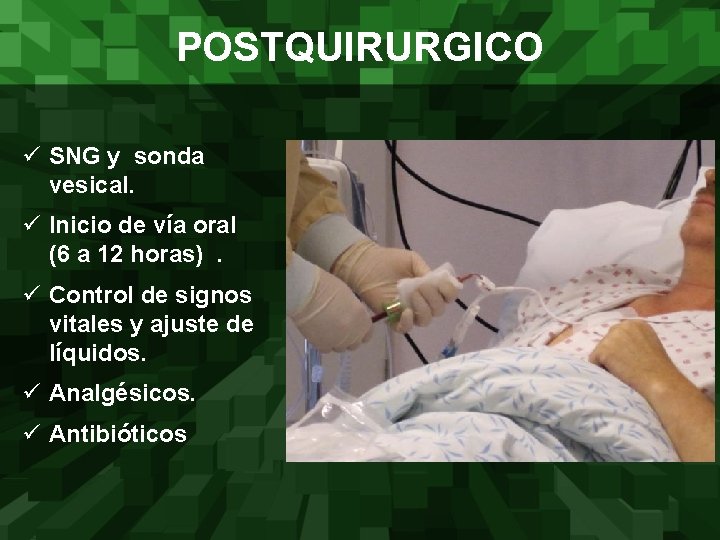 POSTQUIRURGICO ü SNG y sonda vesical. ü Inicio de vía oral (6 a 12