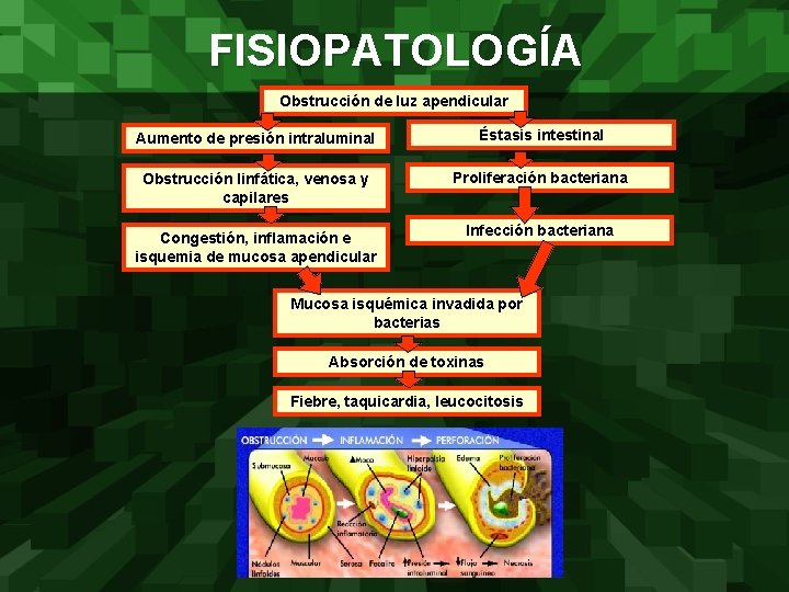 FISIOPATOLOGÍA Obstrucción de luz apendicular Aumento de presión intraluminal Éstasis intestinal Obstrucción linfática, venosa