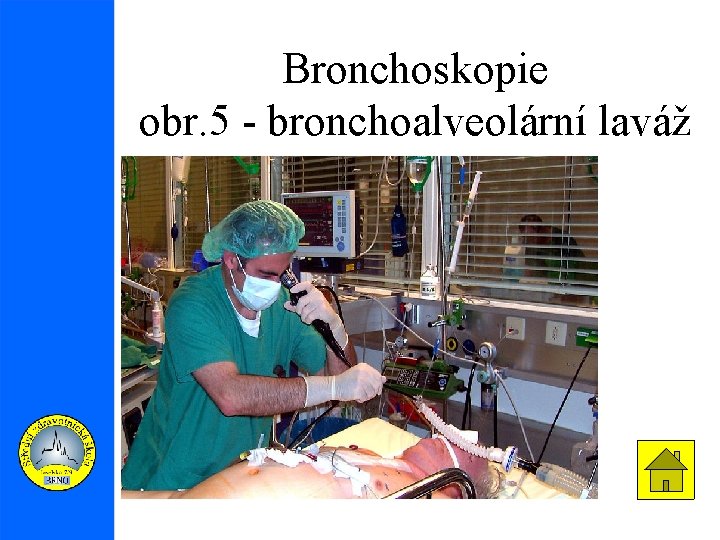 Bronchoskopie obr. 5 - bronchoalveolární laváž 