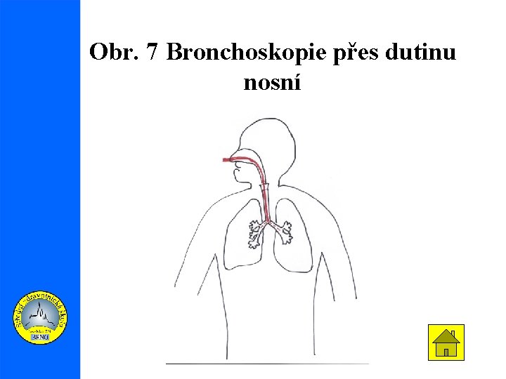 Obr. 7 Bronchoskopie přes dutinu nosní 