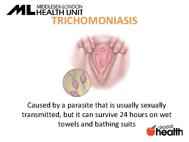 TRICHOMONIASIS Caused by a parasite that is usually sexually transmitted, but it can survive