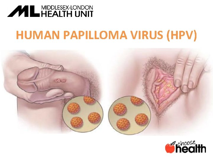 HUMAN PAPILLOMA VIRUS (HPV) 